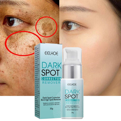 Belro anti-dark spot skin care product showing a tube with lightening pigmentation spots on the skin.