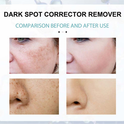 Belro anti-dark spot skin care bottle with lightening formula for pigmentation spots on a white background