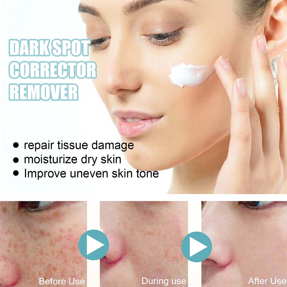 Belro anti-dark spot skin care product for lightening pigmentation and evening skin tone, shown in the image.