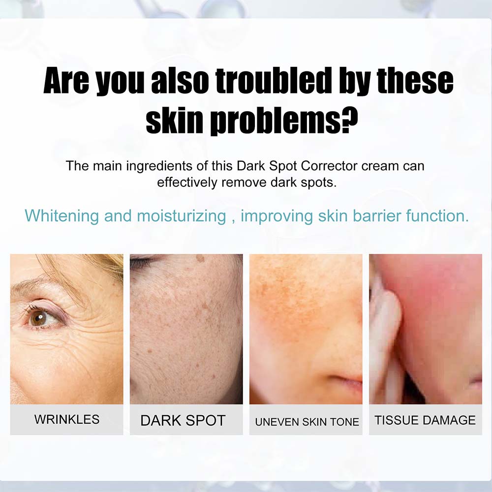 Belro anti-dark spot skin care product showing a tube with lightening pigmentation spots and skincare ingredients on the packaging