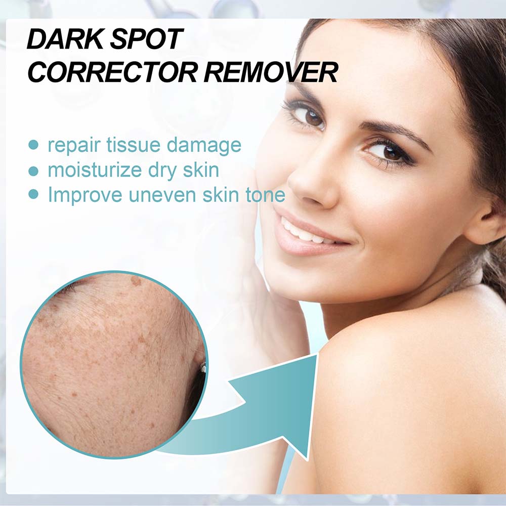 Belro anti-dark spot skin care product showing a sleek tube with lightening pigmentation spots for even skin tone.
