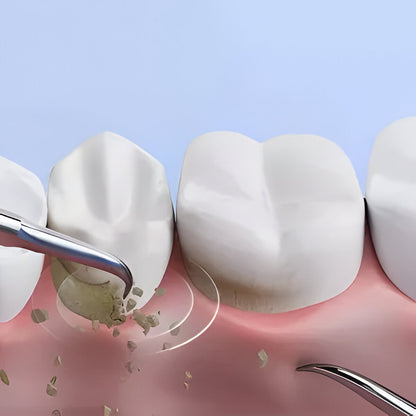 Belro ultrasonic scaler for dental cleaning, featuring a sleek electronic design with a handheld tip.