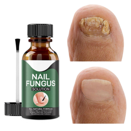 Belro Goodbye Fungus nail care product displayed on a white background, featuring Montserrat branding and health and beauty packaging.