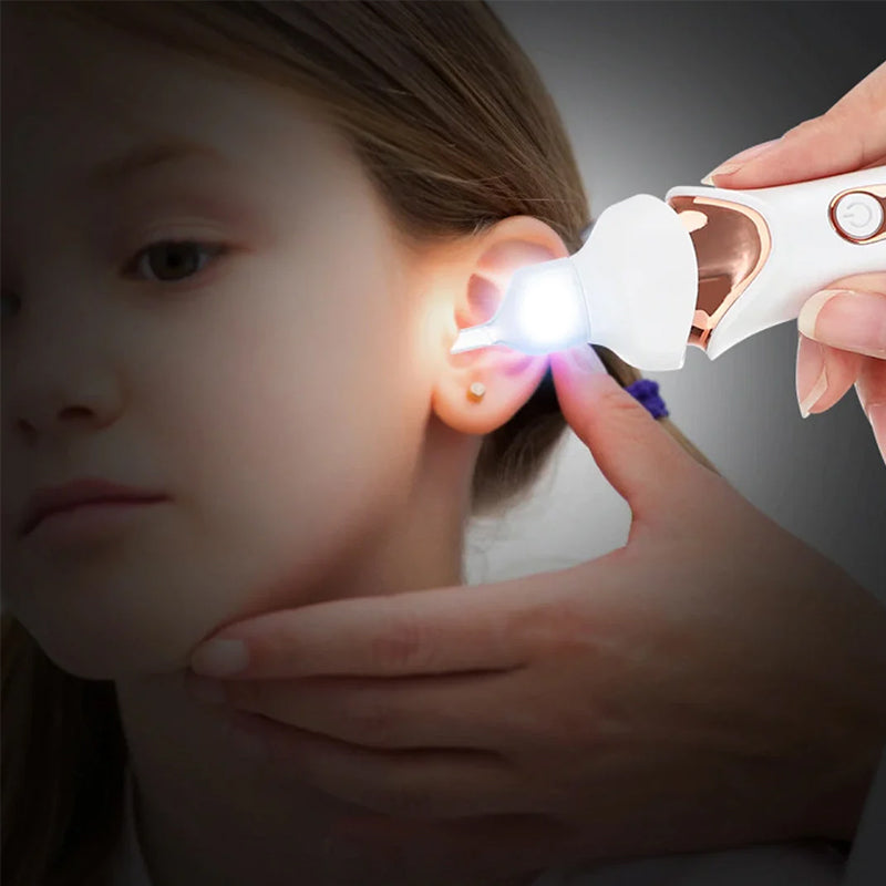 Belro 5-in-1 electric earwax remover with various attachments, shown with ergonomic handle and cleaning heads for safe ear cleaning.