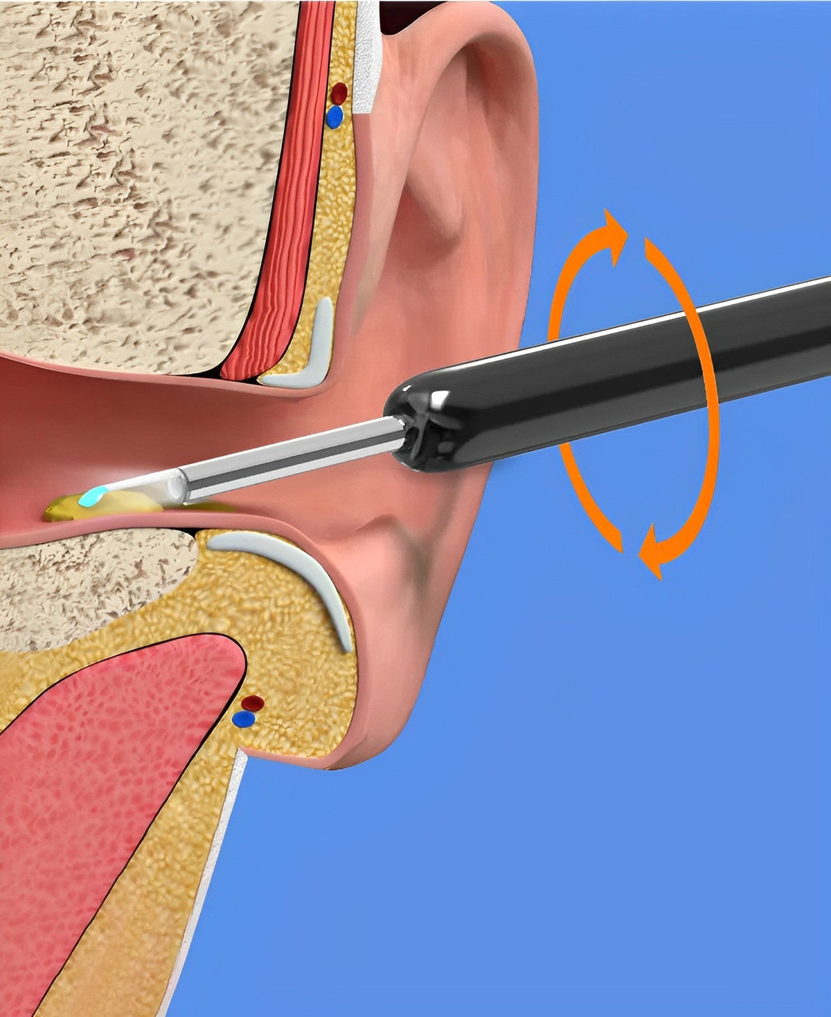Belro EarBit 3000 ear cleaning tool with built-in camera, showing the device and camera lens for safe ear inspection.