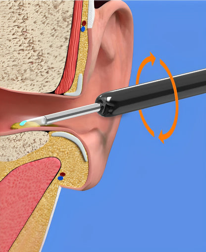 Belro EarBit 3000 ear cleaning tool with built-in camera, showing the device and camera lens for safe ear inspection.