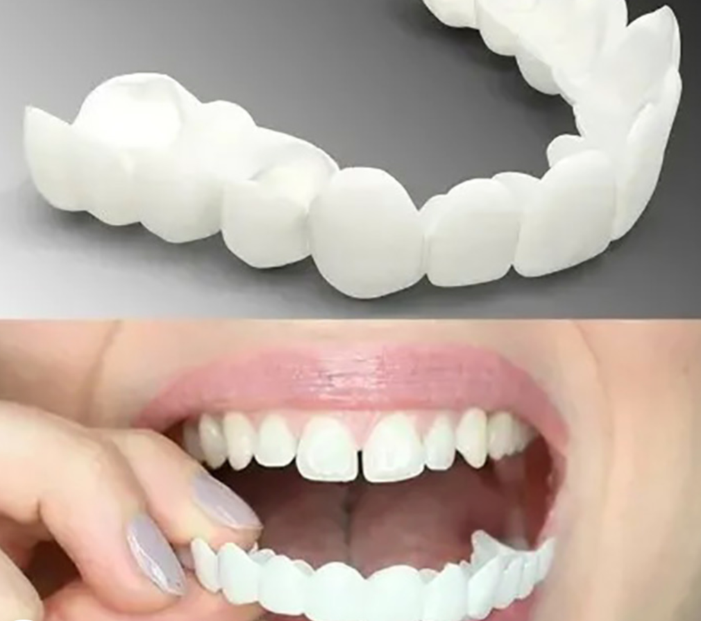 Belro adjustable snap-on dentures for oral care, showing a close-up of the denture with adjustable features and secure fit.