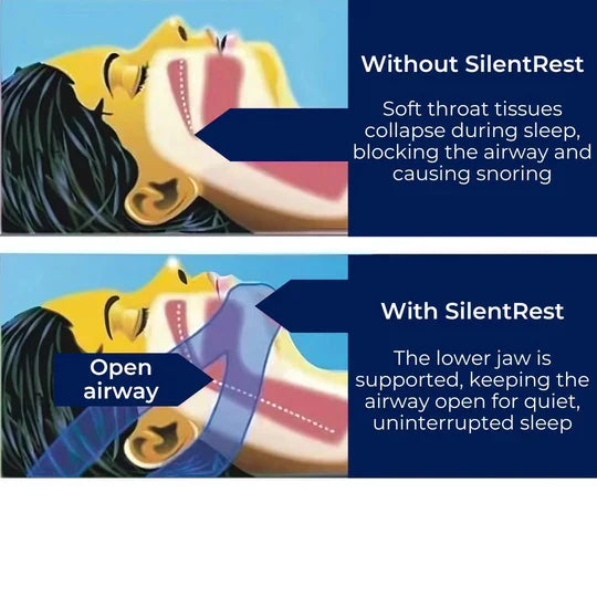 Belro SilentRest full head chin strap for snoring relief and sleep apnea support, shown on a white background, comfortable all-night use.