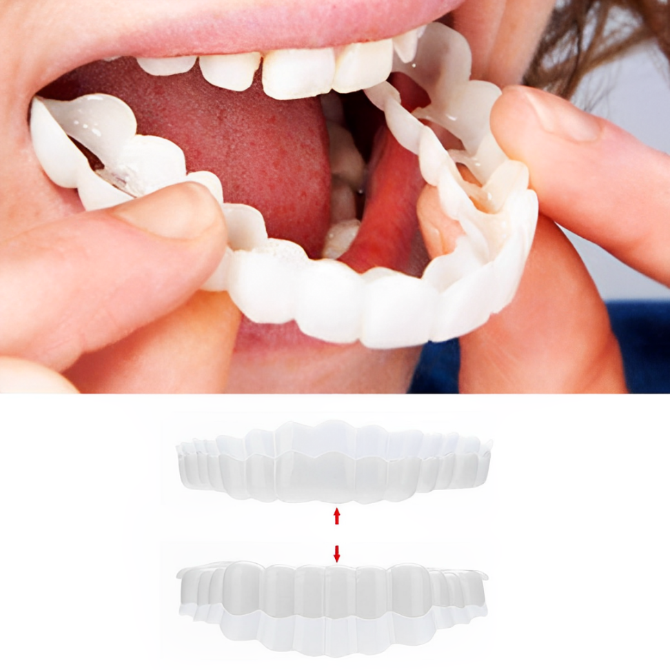 Belro Smile Veneer set with upper and lower veneers for dental enhancement, shown in natural color on a neutral background.