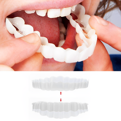 Belro Smile Veneer set with upper and lower veneers for dental enhancement, shown in natural color on a neutral background.