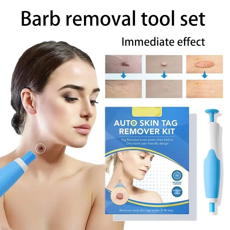 Belro Skin Tag Removal Kit for men, featuring tools and products to safely remove skin tags at home.