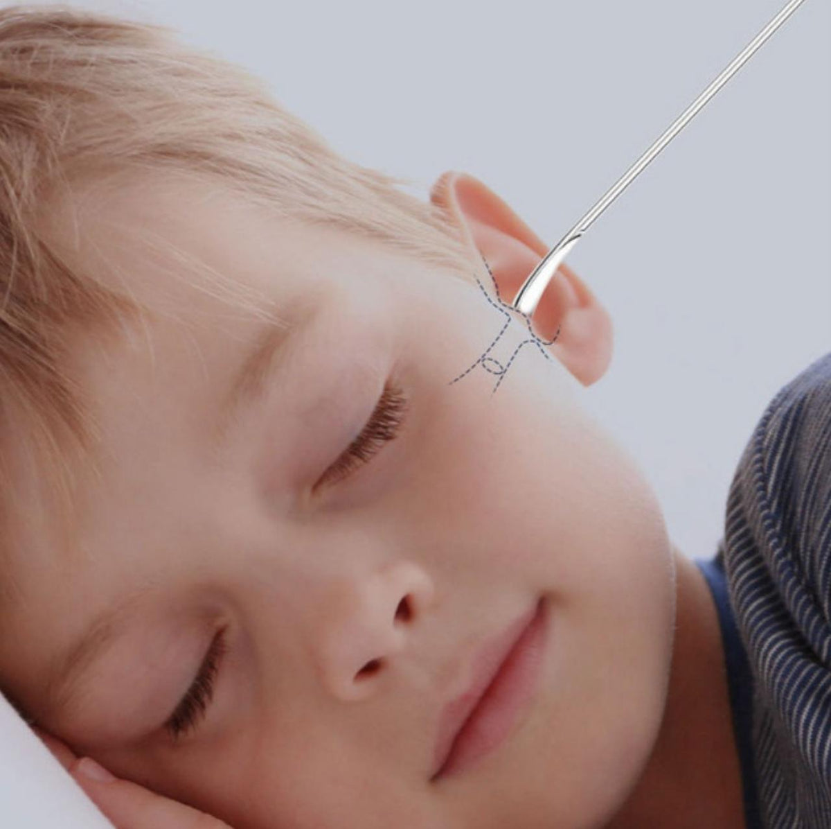 Set of six Belro ear care tools for cleaning and maintaining ear hygiene, featuring small, safety-designed tips.