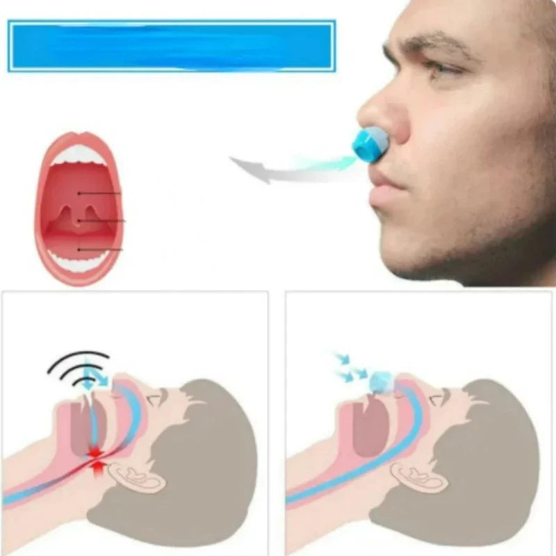 Belro 2-in-1 anti-snore nose clip and air purifier device for improved sleep and breathing comfort.