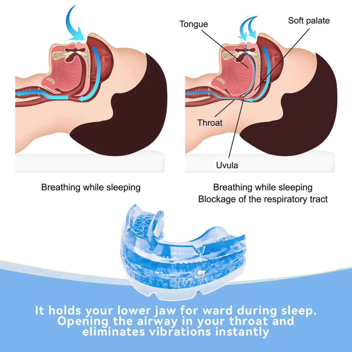 Belro adjustable anti-snore mouthpiece designed to reduce snoring and improve sleep comfort, shown on a white background.