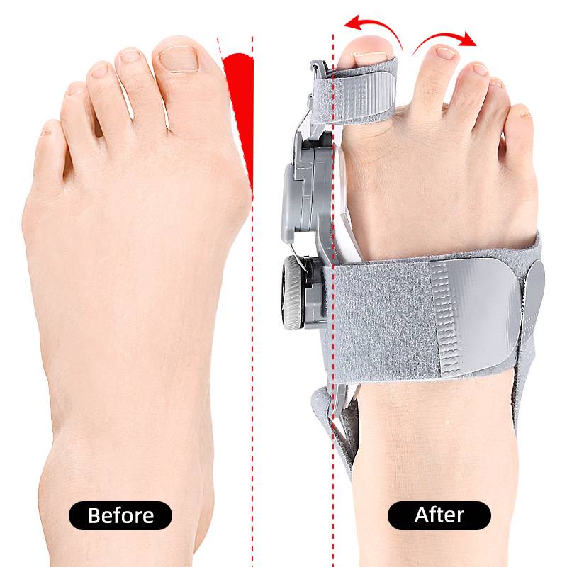 Belro Natural Bunions Corrector Toe Spacer showing clear silicone design for realigning toes and relieving bunion discomfort.