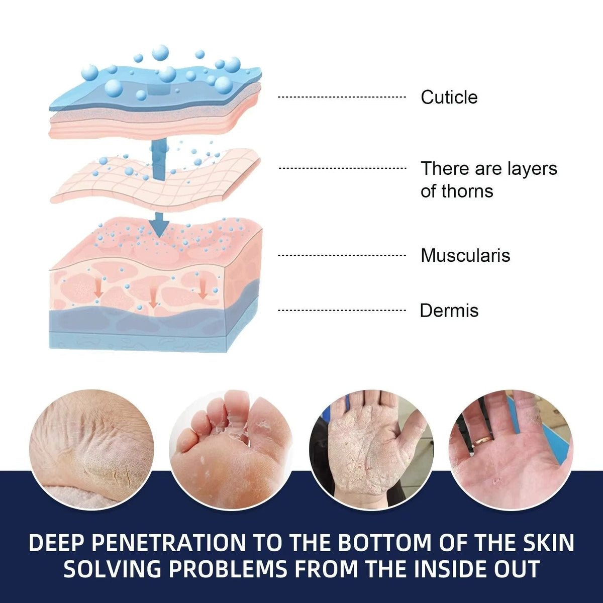 Belro cracked foot heel treatment 3-pack with moisturizing creams for dry, rough heels in a health and beauty setting.