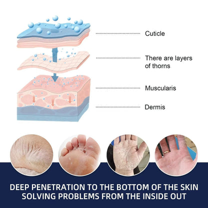 Belro cracked foot heel treatment 3-pack with moisturizing creams for dry, rough heels in a health and beauty setting.