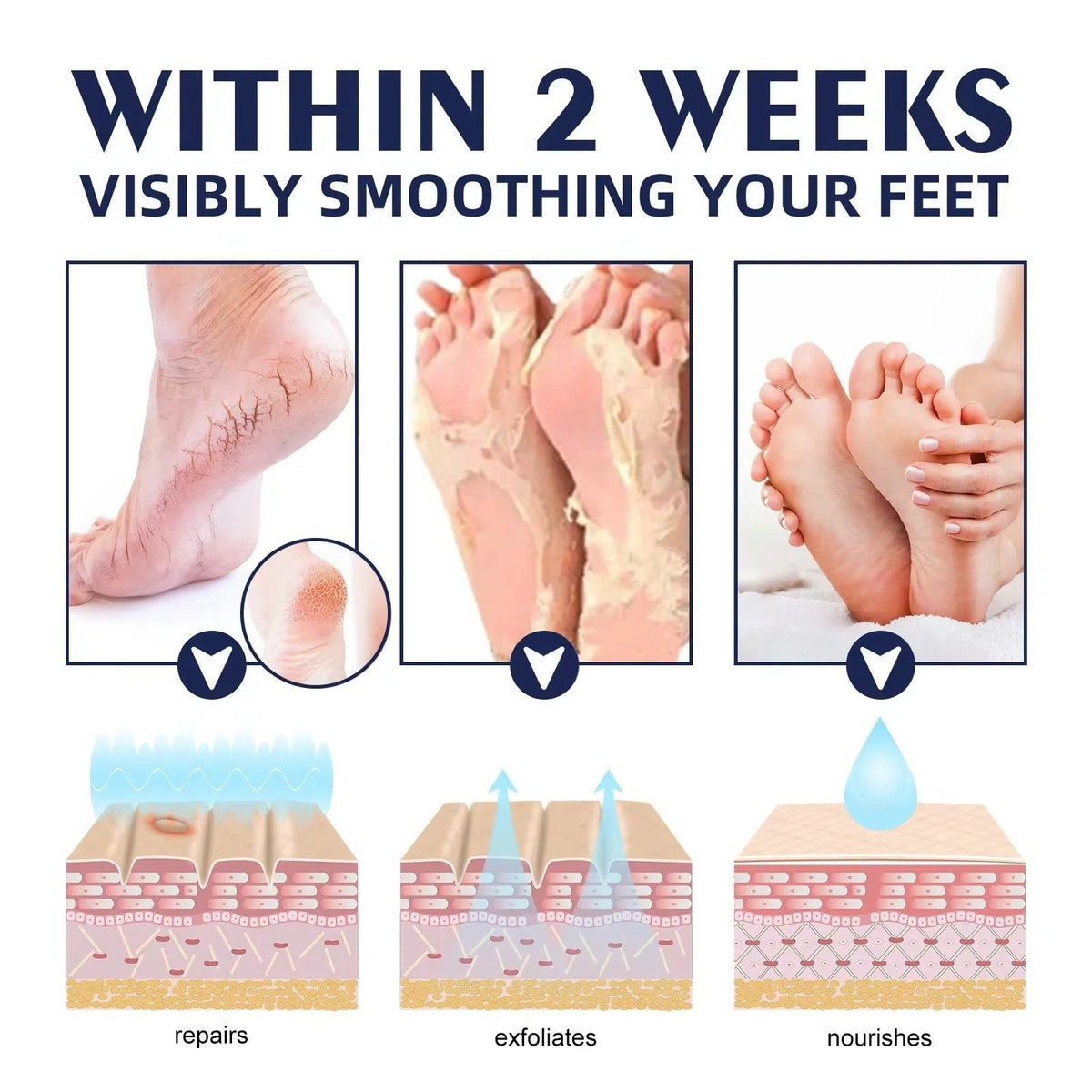 Belro Cracked Foot Heel Treatment 3-pack, soothing skincare products for dry, cracked heels, and rough skin.