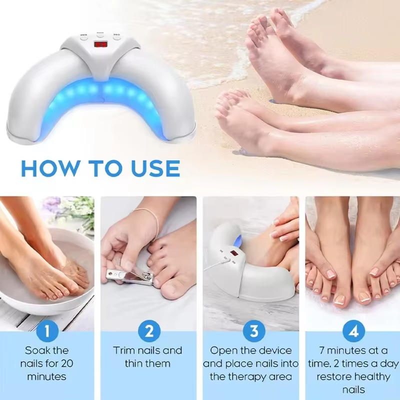Belro Nail Fungus Laser device with LED lights, used for targeted treatment of nail fungus in a compact electronic design