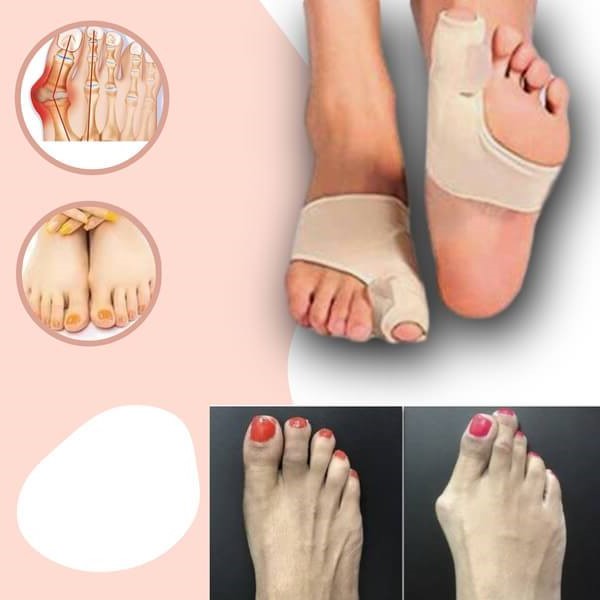 Belro orthopedic toe bunion corrector shown on toes, designed to realign and relieve bunion pain for foot health and comfort.
