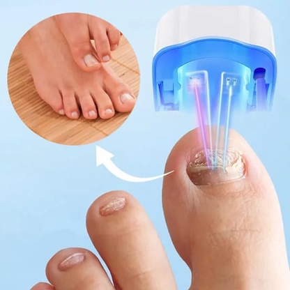 Belro Nail Fungus Cleaning Laser Device for health and beauty, shown with its sleek design and control panel.