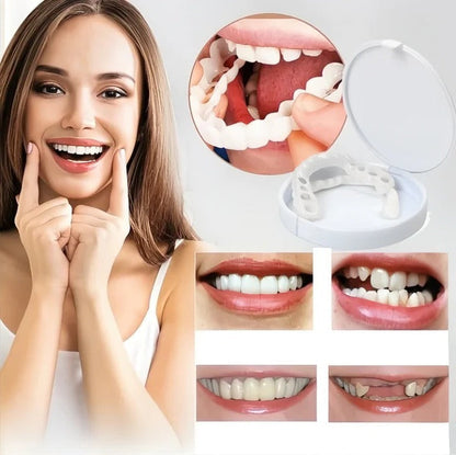 Close-up of Belro teeth veneers showing a natural white finish on a person's smile, highlighting oral care and cosmetic enhancement.