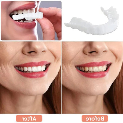 Belro teeth veneers with natural white finish, showcasing a close-up of the smooth, aesthetic dental veneer for improved smile appearance.
