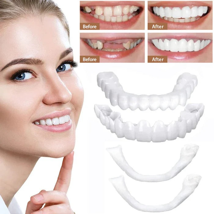 Belro dental veneers with natural white finish, showcasing realistic tooth-like appearance for improved smile aesthetics.