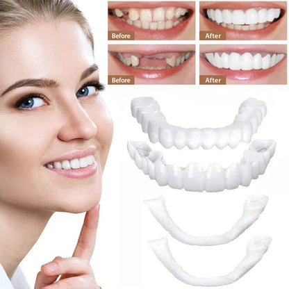 Belro dental veneers with natural white finish, showcasing realistic tooth-like appearance for improved smile aesthetics.