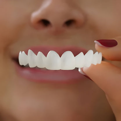 Belro teeth veneers with a natural white finish, showcasing smooth, realistic-looking dental enhancement for a bright smile.
