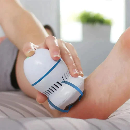 Belro Foot Smoothie cracked heels treatment in a jar, showing the skincare product with a smooth, creamy texture for heel care.