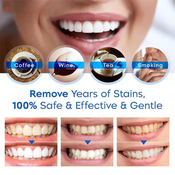 Belro Teeth Whitening Essence Pen for oral care, shown with white pen and applicator tip, in health and beauty setting.