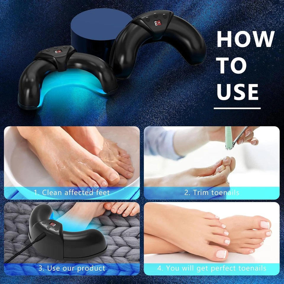 Belro Nail Fungus Laser device used for treating nail infections, featuring sleek electronic design and LED light technology.