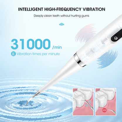 Belro dental tartar removal teeth cleaner tool with LED light, handheld electronic device for oral hygiene, close-up view