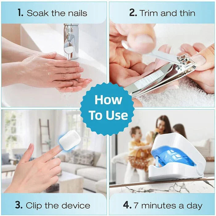 Belro Nail Fungus Cleaning Laser Device for toenail diseases, featuring high-efficiency light therapy for health and beauty.