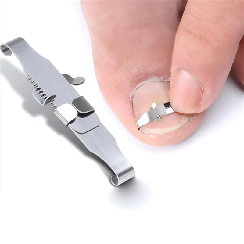 Belro ingrown toenail corrector tool for foot care, designed to help straighten and relieve ingrown toenails effectively.