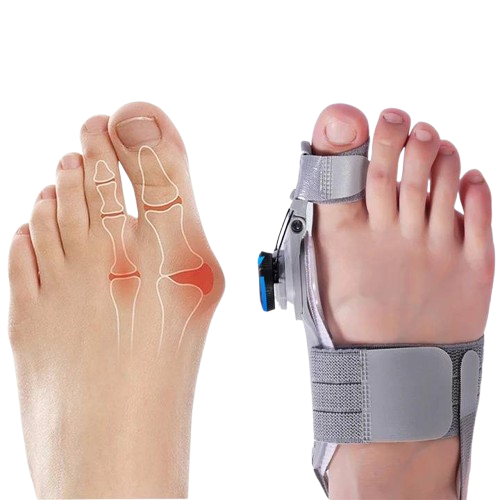 Belro Natural Bunions Corrector Toe Spacer for toe alignment and foot comfort in health and beauty products.