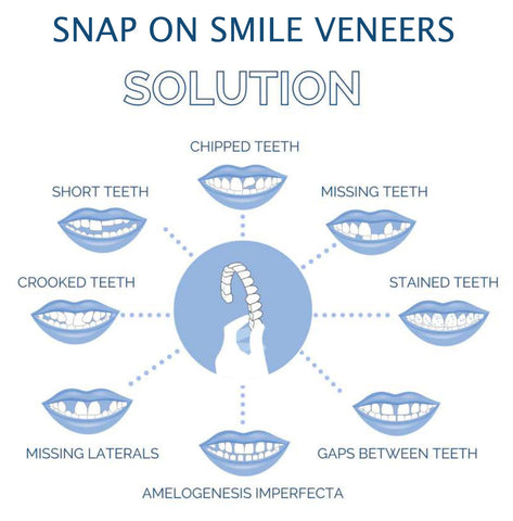 Belro Smile Veneer set for upper and lower teeth, designed for oral care and teeth whitening, shown in the image.