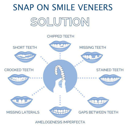 Belro Smile Veneer set for upper and lower teeth, designed for oral care and teeth whitening, shown in the image.