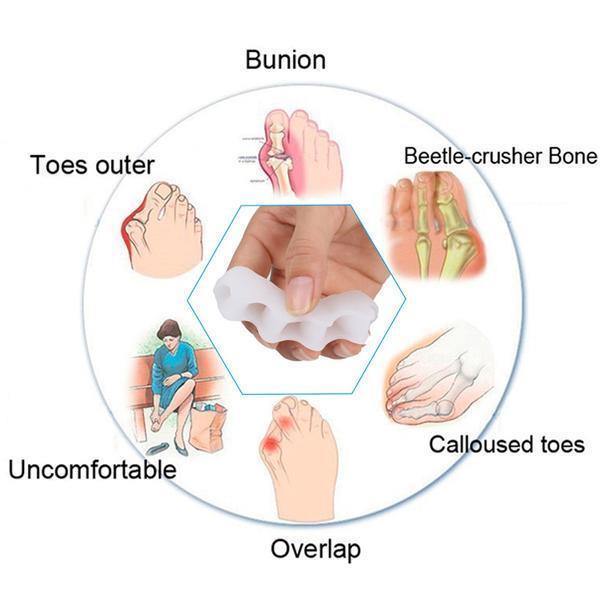 Belro Orthopedic Toe Corrector and Separator showing adjustable silicone design for toe alignment and comfort.