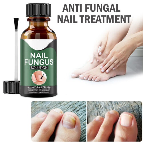 Belro Goodbye Fungus nail care product in a sleek bottle, designed to treat fungal nail infections effectively.